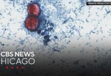 Source: Cyclospora outbreak tied to lettuce served at some Taco Bell restaurants