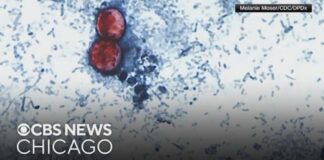Source: Cyclospora outbreak tied to lettuce served at some Taco Bell restaurants